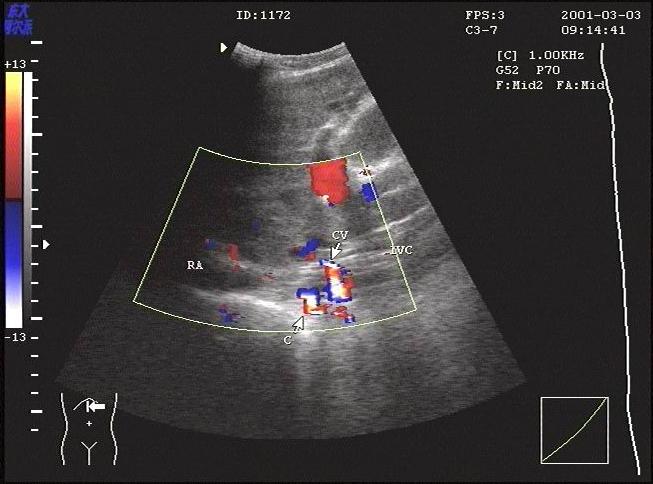 B超工作站/超声工作站
