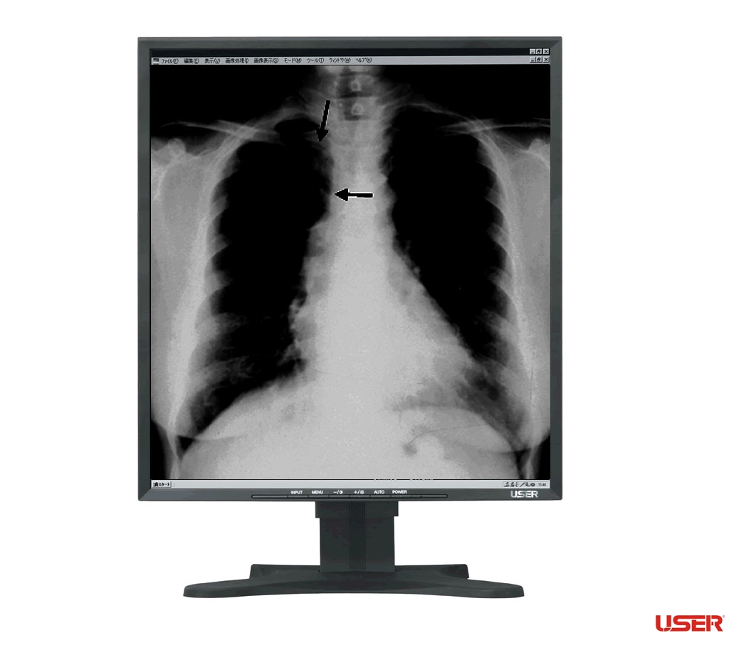 21.3寸 医用单色显示器