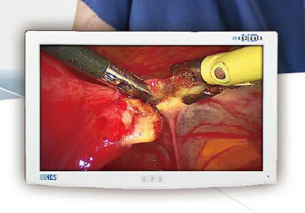 供应美国NDS21寸液晶监视器